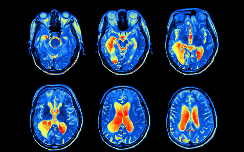 Neuroscience Exploration Program
